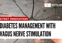 Diabetes Management With a Pacemaker-Like Implant Diabetes Management With a Pacemaker-Like Implant