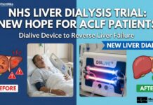 NHS Trials Dialive: A Breakthrough Life-Saving Treatment for Acute-on-Chronic Liver Failure NHS Trials Dialive: A Breakthrough Life-Saving Treatment for Acute-on-Chronic Liver Failure