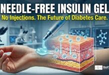 Needle-Free Insulin Breakthrough: New Skin Gel Could Transform Diabetes Treatment Needle-Free Insulin Gel for Diabetes Treatment