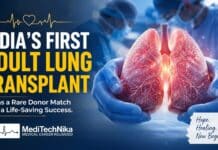 India’s First Adult Lung Transplant Turns a Rare Donor Match into a Life-Saving Success A woman with rheumatoid arthritis-associated lung disease gets a second chance after India's first adult lung transplant using teen donor.