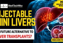 Injectable “Mini Livers” Could One Day Offer an Alternative to Liver Transplants Injectable mini liver technology showing satellite liver tissue being injected to support liver function as a potential alternative to liver transplantation, based on MIT regenerative medicine research.